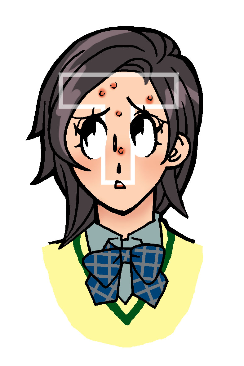 白にきびに漢方