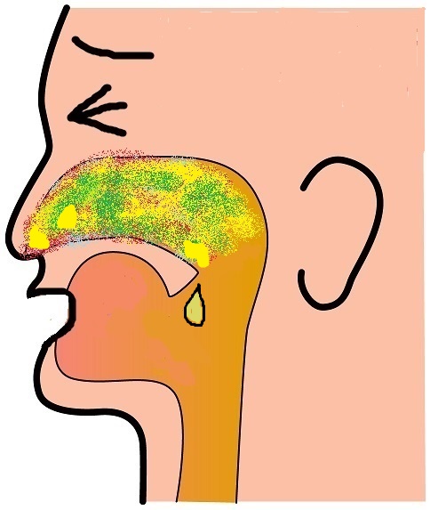 �A�����M�[���@���ɐV���̊����a�@