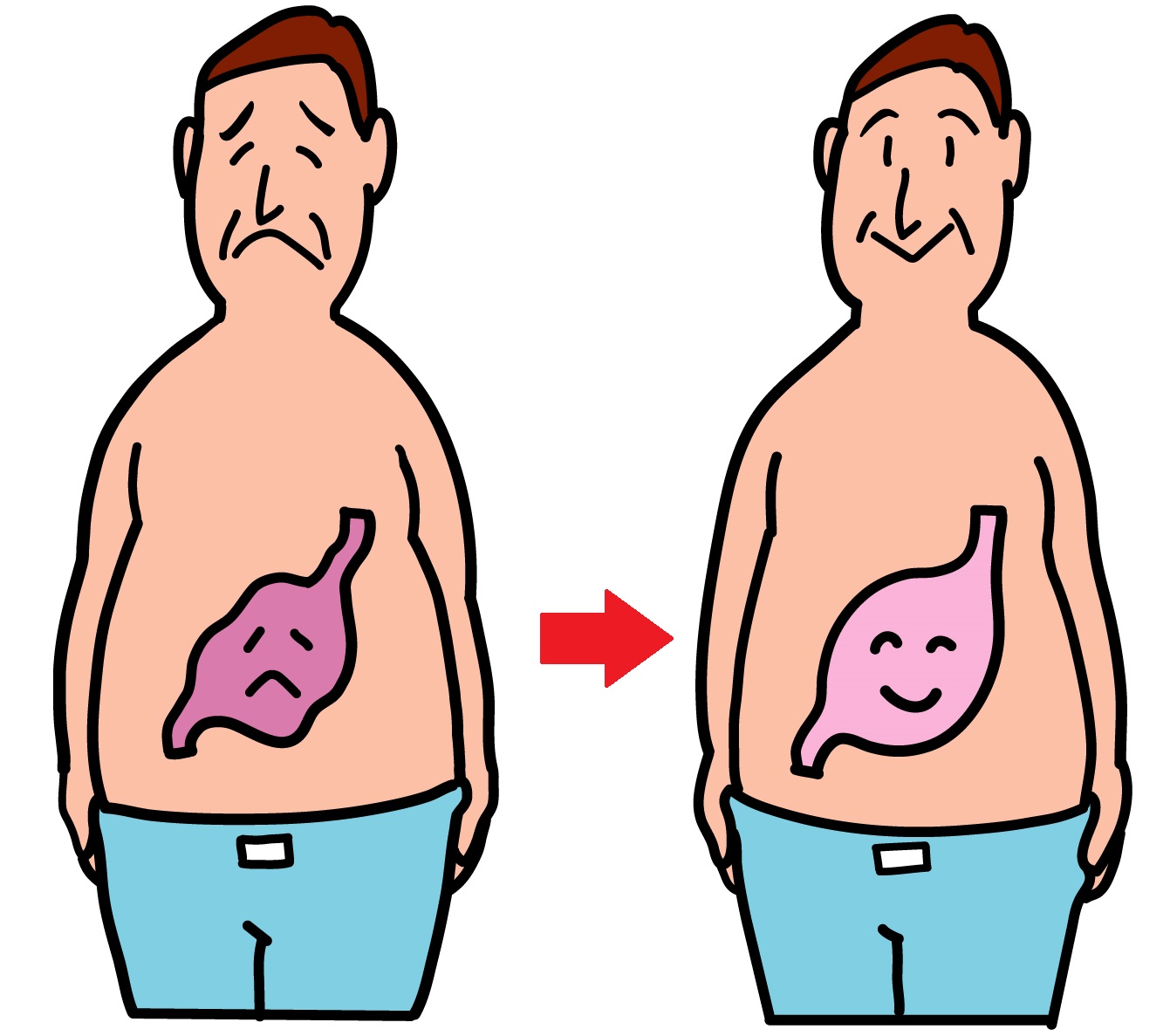 体質改善の漢方で胃の症状改善