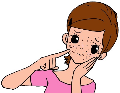 白にきびに漢方