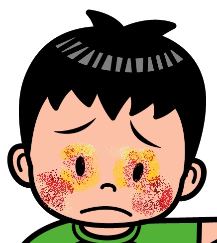 �ڂ̎���̃A�g�s�[�Ɋ���