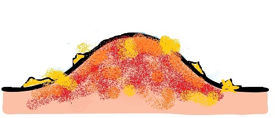 �����ߕq�ǂɊ���